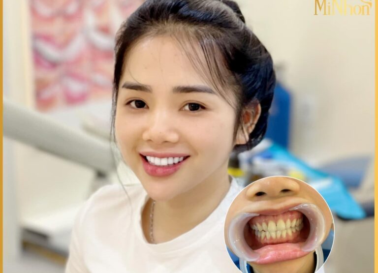 Thẩm mỹ viện Quốc tế Minhon – Dịch vụ về răng đặc biệt được ưa chuộng